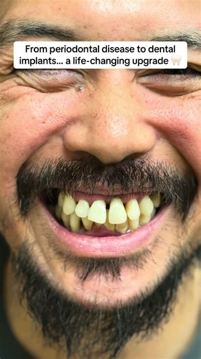 Dental implants don’t just replace missing teeth—they help restore function and confidence