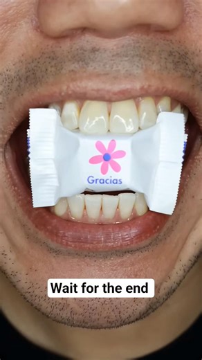 Satisfying Eye Candy ASMR: India vs USA #USA #eating #shorts