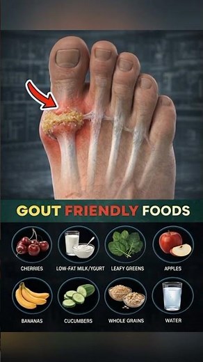 Early Warning Signs of Gout and Foods That Help Prevent Painful Attacks