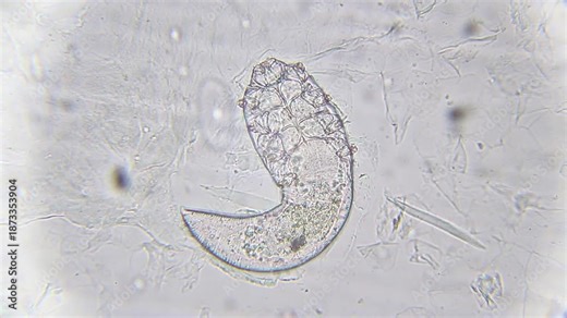 Demodex brevis mite in a curved position, moving under 400x brightfield microscopy. Visible body structure and internal organs in high-detail microscopic view.