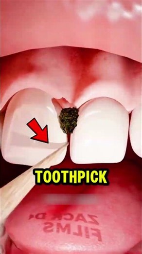 Think Toothpicks Clean Your Teeth The Truth Might Surprise You! 🦷😳