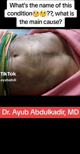 #viralvideo #following #prescription #laboratory #tiktok #viralvideo #examination #followers😘thanku🙏🙏❤️❤️❤️ #education #parasitology #anatomyclass #pharmacy #mbbs #physiology #video