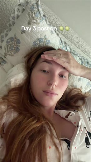 Day 3 Post-Op Experience After Breast Implants