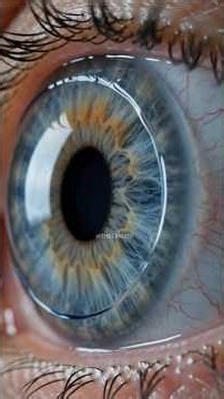 How Contact Lenses ACTUALLY Stick To Your Eye 👁️ #shorts