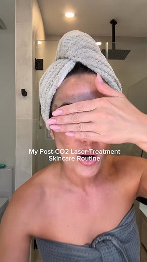 136K views · 412 reactions | Got CO2 Laser Resurfacing and Fraxel done on my face a few days ago, so I just want to show you the post-care products @skinandsweat sent me home with afterwards. | Susan Yara | Facebook