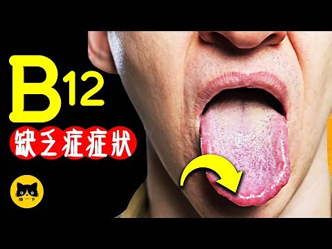 b12 | Vitamin b12 | 維他命 b12缺乏症的身體症狀