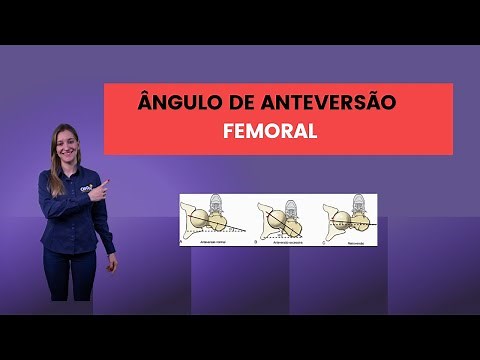 Ângulo de anteversão femoral