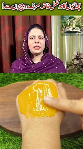 malasma treatment only 2 ingredients NayimaApa #healthawareness #health #skincare #skincaretips #fyp