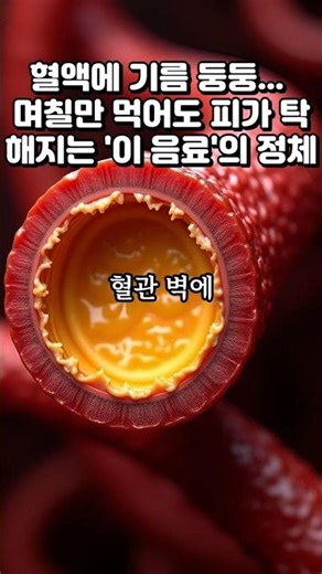 혈액에 기름 둥둥... 며칠만 먹어도 피가 탁해지는 '이 음료'의 정체 #고지혈증 #액상과당 #혈관건강 #중성지방 #응급의학과 #혈액순환 #건강꿀팁 #심근경색예방 #유튜브쇼츠