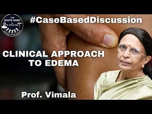 Clinical Approach to Edema - Case based discussion