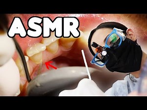 ASMR Dental Cleaning - LOTS of Scraping
