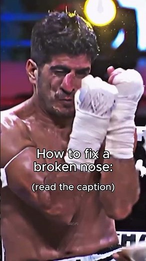 How to FIX a broken nose! #ufc #mma #boxing #doctor