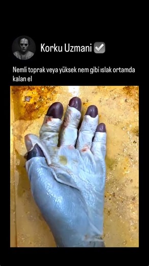 Sorumluluk Almıyoruz 🔞 on Instagram: "Bir vücut su, nemli toprak veya yüksek nem gibi ıslak bir ortamda kaldığında, cilt maserasyon adı verilen bir süreçten geçer. Cildin dış tabakası suyu emer, şişer ve zayıflar; bu da cildin soluk, buruşuk ve yumuşak görünmesine neden olur. Bu yüzden parmak uçları ve ayak parmakları önce karakteristik “buruşmuş” görünümü alır; buna bazen çamaşırcı kadını cildi de denir. Zaman geçtikçe, uzun süreli nem cilt katmanları arasındaki bağları bozar. Epidermis, daha 