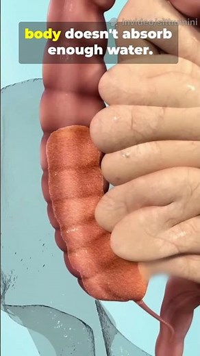 How Long Poop Stays in Your Body — And Why It Matters!