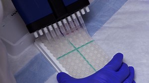 Video: A High-Throughput Multiplexed Screening for Type 1 Diabetes, Celiac Diseases, and COVID-19