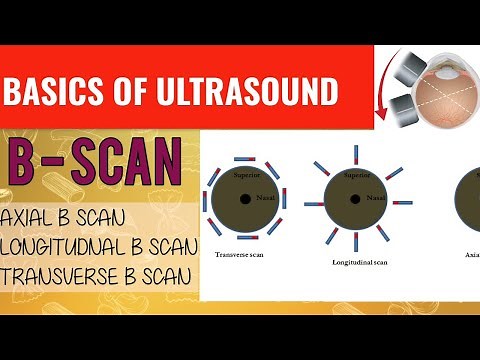 #2 B SCAN COURSE|| AXIAL, LONGITUDINAL & TRANSVERSE B-SCAN || TOPOGRAPHIC, KINETIC B-SCAN.||