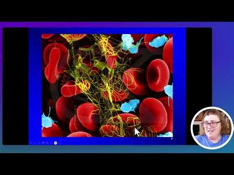 A&P2 Cardiovascular System Module 2: Hemostasis