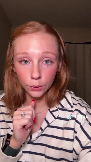 Part 3 cyst “popping” #cyst #pimplepopping #fail #fypシ゚viral