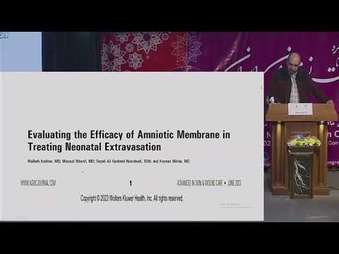 Application of an amniotic membrane dressing for extravasation injury in a newborn.