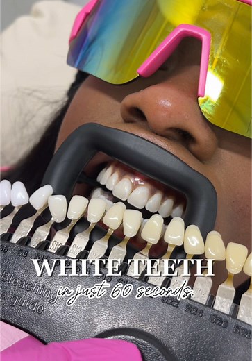 Amazing 1-Hour Teeth Whitening Transformation Revealed