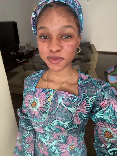 Learn the Rema Calm Down Dance Step by Step