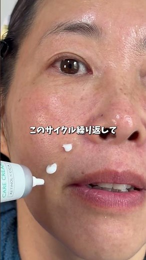 How anyone can get rid of laugh lines❤️‍🔥✨#Kiten #Retinol #AgingCare #AntiAging #PR