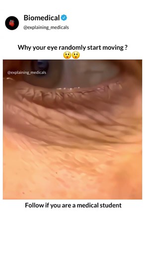 That random eye twitch you feel?