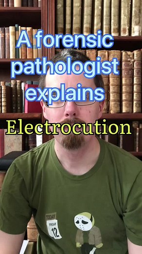 #forensicpathology #forensicpathologist #pathology #pathologist #medicalexaminer #coroner #autopsy #postmortem #doctor #doctorsoftiktok #surgicalpathology #surgery #surgeon #gross #electricity #electric #electrocution #electrifying #shock #shocking #electricslide #stream #biology #biologist #science #physics #mystery #detective #nurse #medstudent #health #execution #explain #teaching #facts #charger #death #metal #conductor #resistance
