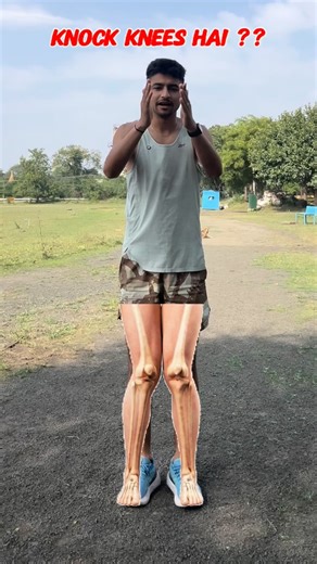 • knock knees solution exercise . - - - #trackandfield #lovers #indianathlete #fitness #instagood #sprinter #fashion #running #sports #instagood #fitindia #knokknee - - ( athletes , sports , running , sprinter , track and field , indian athletics , army , Barthi , 1600mts , sscgd ) | Ath Ritesh
