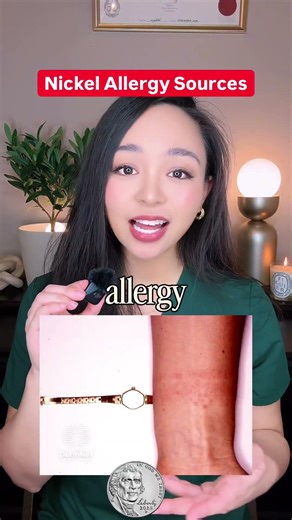 Nickel Allergy Isn’t Just Jewellery | Hidden Triggers of Contact Dermatitis Explained