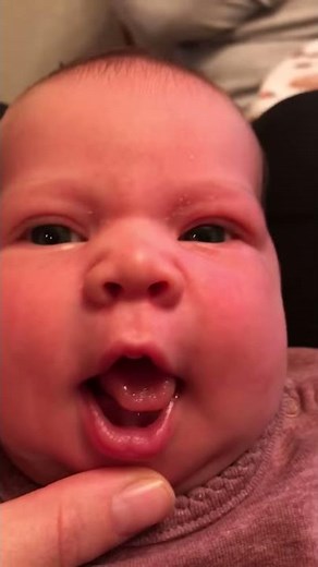 Post Frenotomy exercise: Facilitating tongue ELEVATION