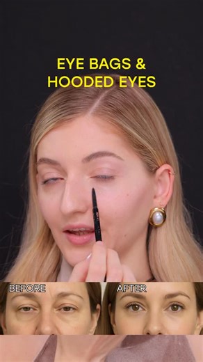 When the eyes release, the whole face changes. Less heaviness. More lift. More light in your gaze 💛 This is what happens when you work with the right muscles. #hoodedeyes #eyebags #facefitness Disclaimer: not a medical advice. For education purpose only. Consult with your physician if you have a medical condition. | Valeriia Veksler
