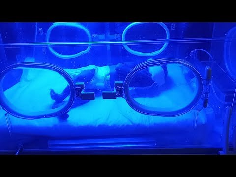 👶 Premature Newborn Phototherapy Treatment | Incubator Care & NICU Eye Tikas Protection