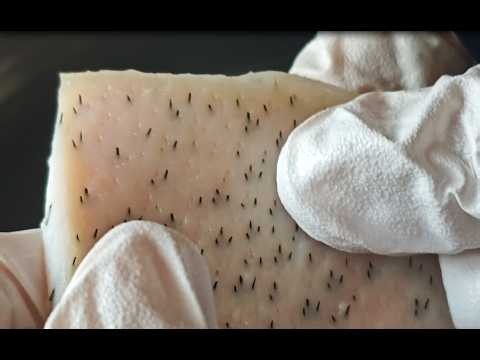 Relax Every Day 🪞 Deep Blackhead Removal ASMR / Satisfying Plucking (No Talking)