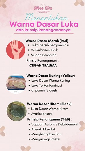 Perawatan Luka: Mengenal Slough dan Jenis Luka