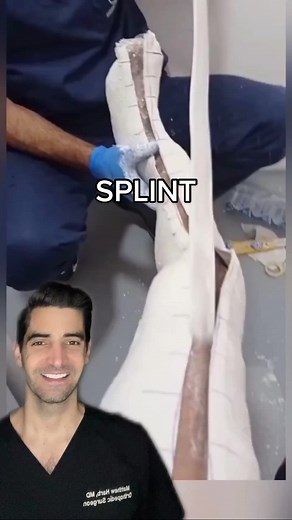 Splint | fracture
