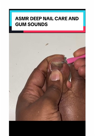 #fyp #viral #asmr #trending #toenail | nails asmr