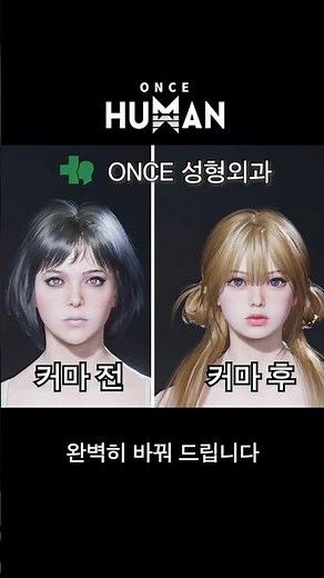 [원스휴먼] 원스 성형외과 OPEN! 커마 전, 후 비교