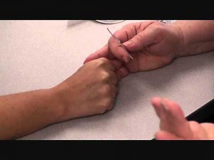 St Philip's AROM Finger goniometry