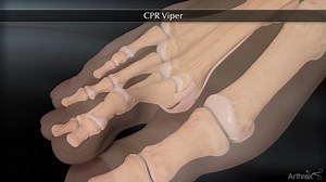 CPR Viper™
