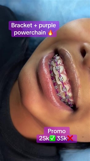 Affordable Fashion Braces in Benin City