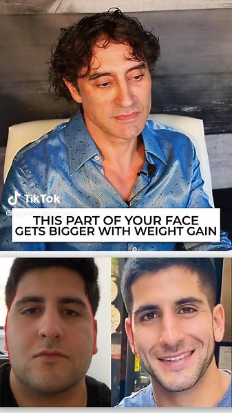 Facial Fat Gain and Weight Distribution in Your Face