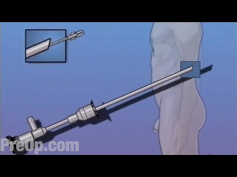 PreOp ® Cystoscopy Male