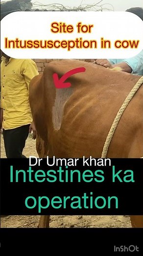 Intussusception l dr Umar khan