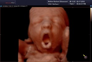 24K views · 342 reactions | Check out this amazing ultrasound compilation video featuring funny things babies do in the womb! | Mother Nurture Ultrasound | Facebook