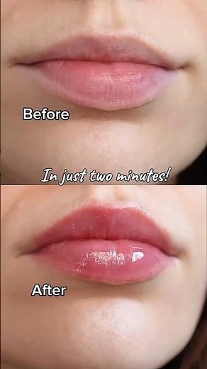 instant lip filler no Botox needed! #vtcosmetics #lipgloss #lipplumper #makeup #lipcare #botox
