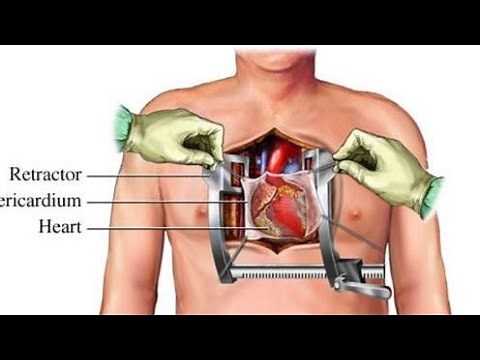 Cardiac OT setup/ equipments for open heart surgery