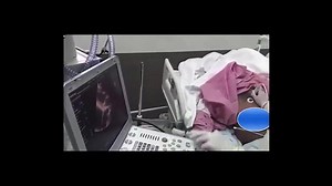 Understand the critical care U/S in the ICU round, a simple way to differentiate between pericardial and pleural effusion. Register in our recorded online course to learn so many critical care U/S tricks which will change your way of management and boost your ICU skills. We are continuously upgrading our courses., so you will expect new lectures to be added to your course from time to time. Attention please, now the complete Lower Limb arterial and venous Doppler course is added to our recorded 