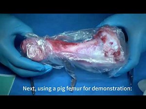 SEGMA Magic Dental Bone Curette