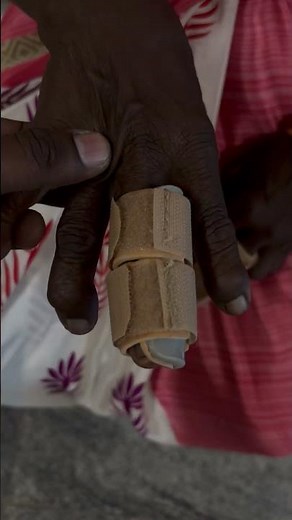 Finger splint#orthosis